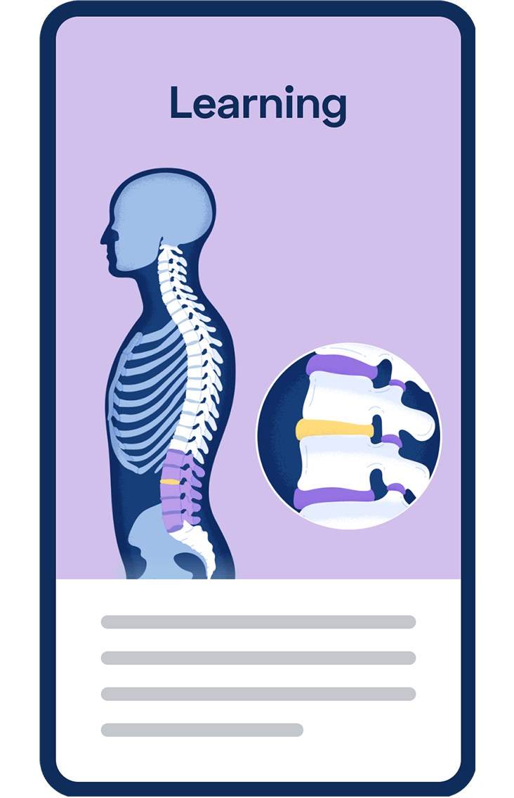 Smartphone illustration of a skeleton with back pain points highlighted.